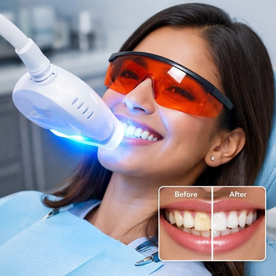 How Many Sessions Are Needed for Laser Teeth Whitening?