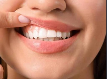 6 Questions To Ask About Strengthening Vulnerable Tooth Enamel